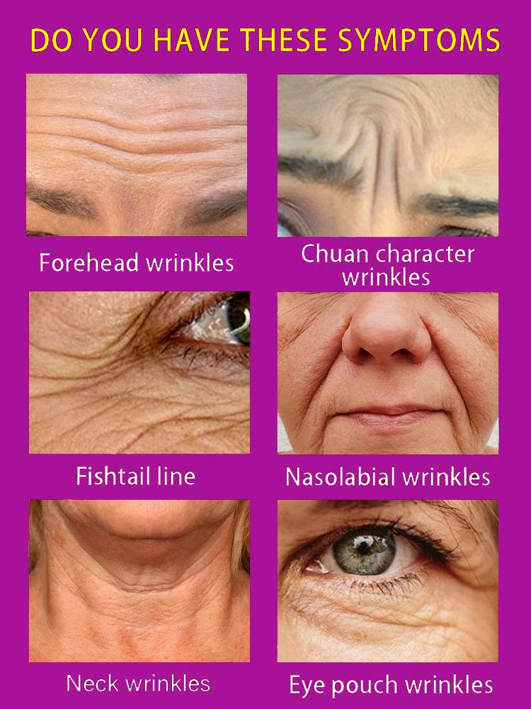 Anti Wrinkle Instant Remover Anti-wrinkle Serum Face Neck Forehead Wrinkles Removal Anti-aging Skin Firming10PCS