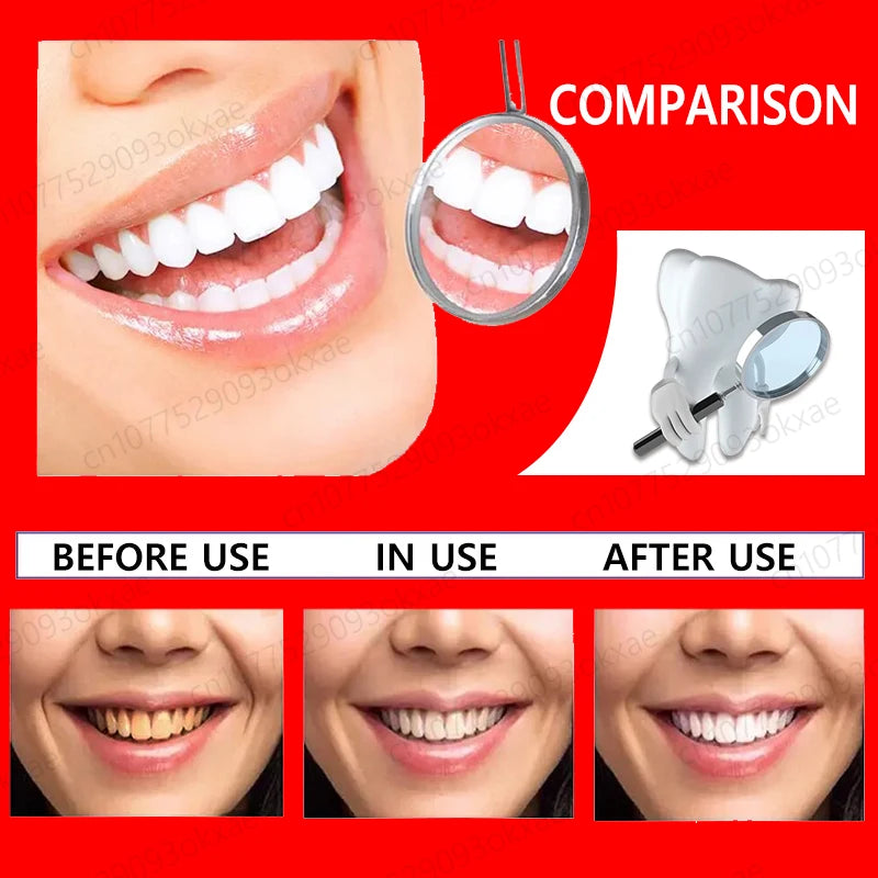 Teeth whitening foam Quickly whiten teeth Remove tooth stains Get rid of plaque Clean teeth