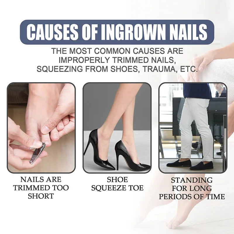 Fungal Nail Laser Device Repair Fast Nails Fungus Onychomycosis Anti Thyroiditis Relief Pure Natural Oil Foot Care Beauty Health