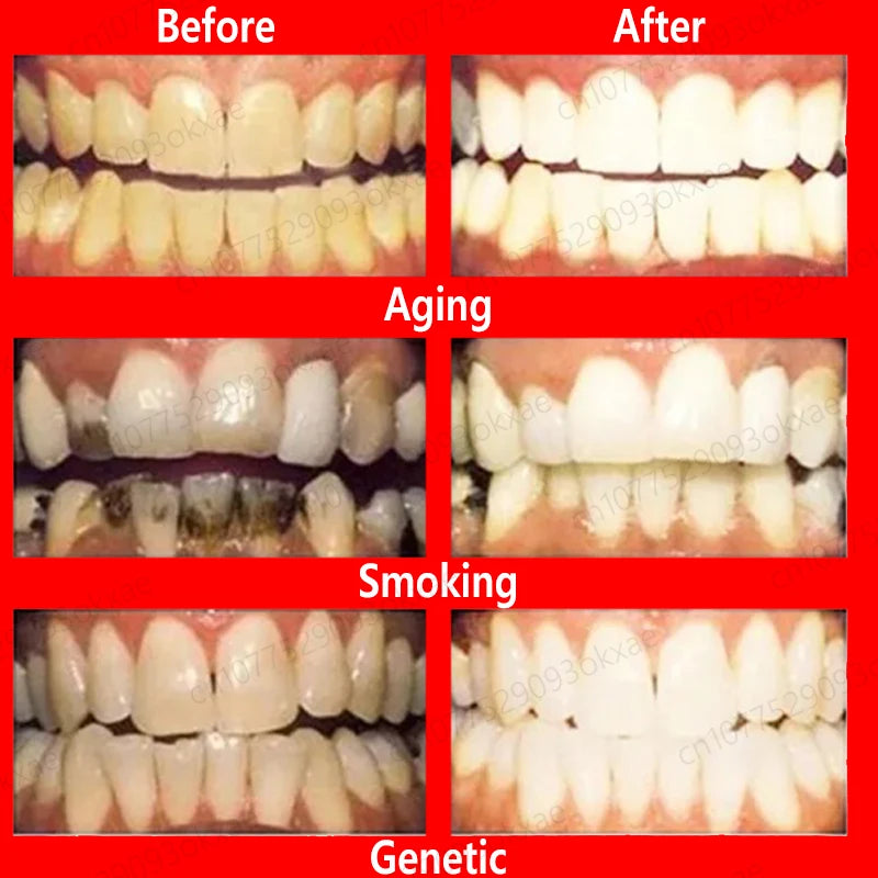 Teeth whitening foam Quickly whiten teeth Remove tooth stains Get rid of plaque Clean teeth