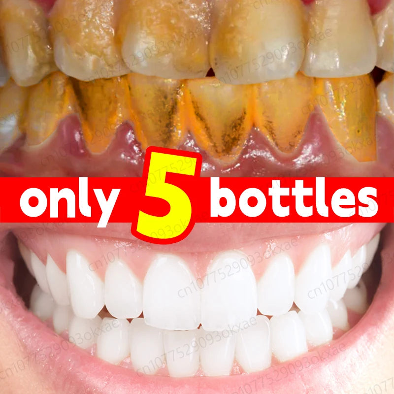 Teeth whitening foam Quickly whiten teeth Remove tooth stains Get rid of plaque Clean teeth