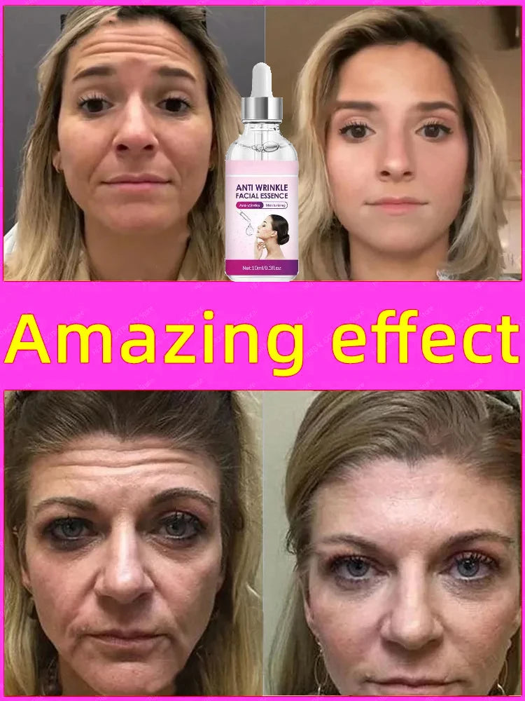 Anti Wrinkle Instant Remover Anti-wrinkle Serum Face Neck Forehead Wrinkles Removal Anti-aging Skin Firming10PCS