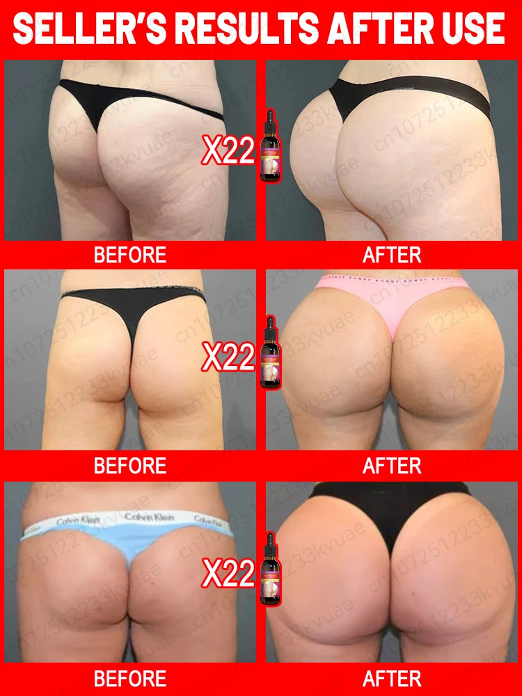 Women's Big Butt Enlargement Essence, improves butt growth, increases body fullness, sexy body care