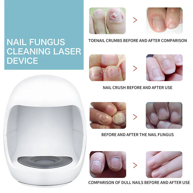 Fungal Nail Laser Device Repair Fast Nails Fungus Onychomycosis Anti Thyroiditis Relief Pure Natural Oil Foot Care Beauty Health