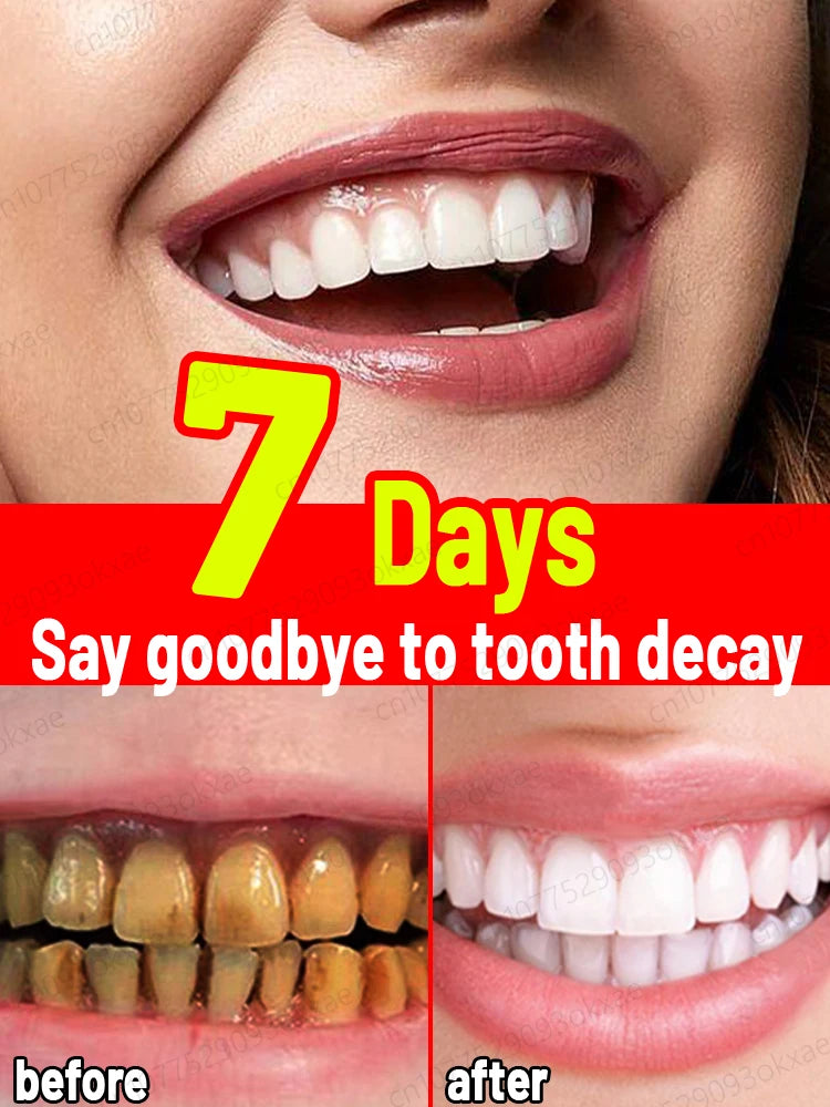 Teeth whitening foam Quickly whiten teeth Remove tooth stains Get rid of plaque Clean teeth