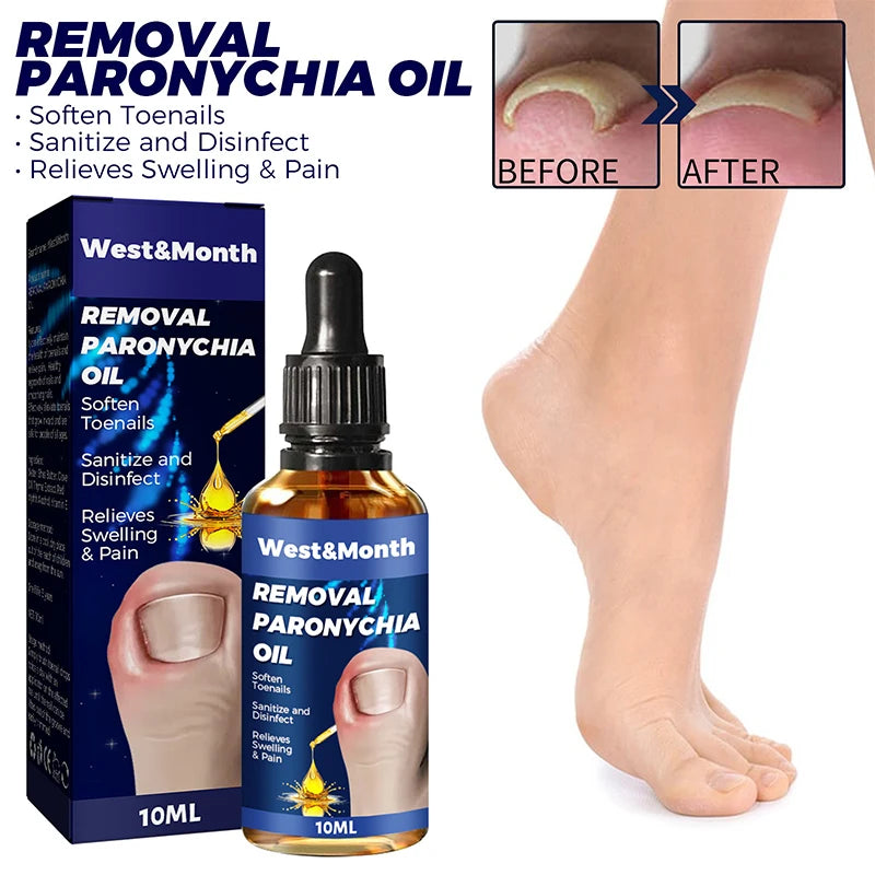 Fungal Nail Laser Device Repair Fast Nails Fungus Onychomycosis Anti Thyroiditis Relief Pure Natural Oil Foot Care Beauty Health