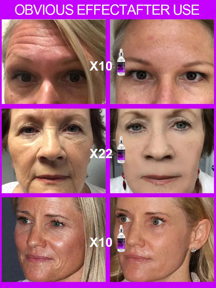 Anti-aging serum Reduce wrinkles Moisturizing Lift sagging skin Care for natural skin Improve collagen Restore skin barrier